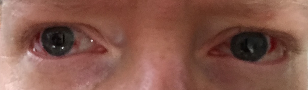 day2